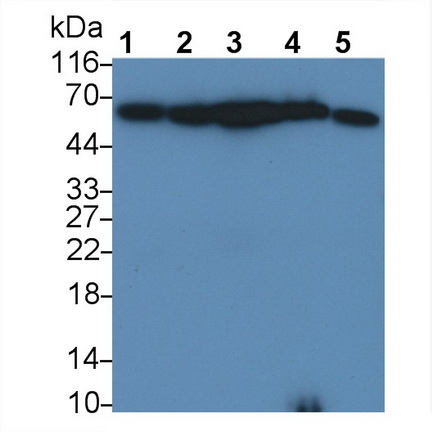Polyclonal Antibody to Phosphatase And Tensin Homolog (PTEN)
