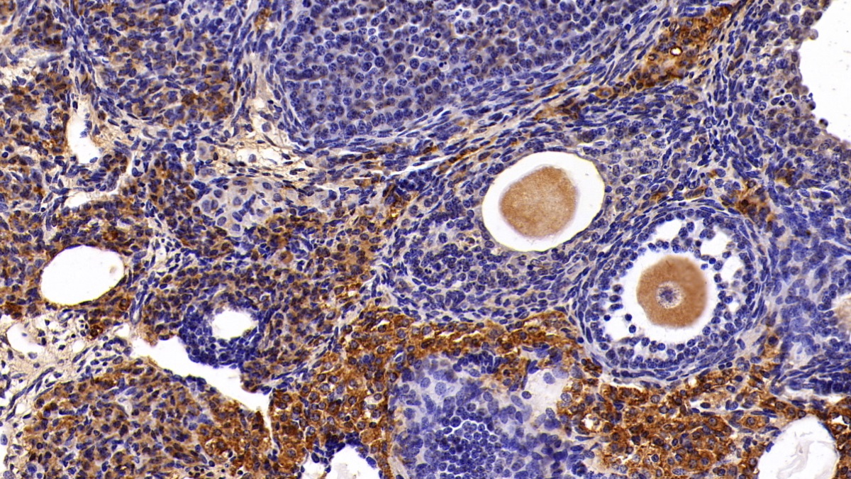 Polyclonal Antibody to Transient Receptor Potential Cation Channel Subfamily M, Member 4 (TRPM4)