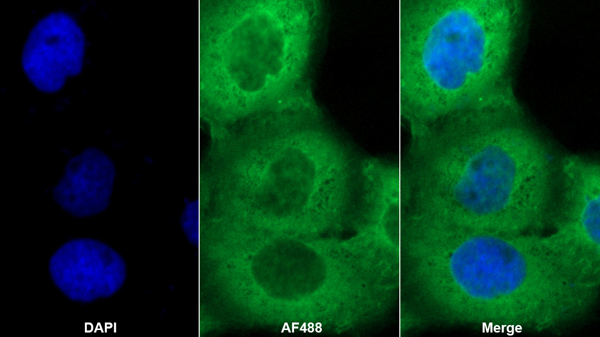 Polyclonal Antibody to Calmodulin Like Protein 5 (CALML5)