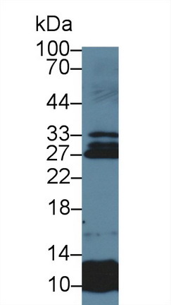 Polyclonal Antibody to Sclerostin Domain Containing Protein 1 (SOSTDC1)