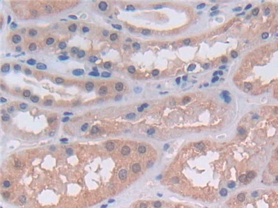 Polyclonal Antibody to Utrophin (UTRN)