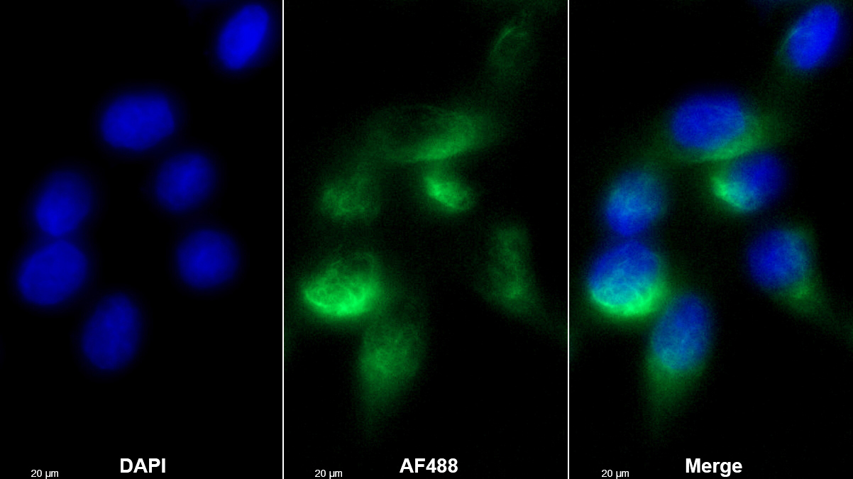 Polyclonal Antibody to Dual Specificity Phosphatase 6 (DUSP6)