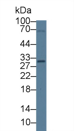 Polyclonal Antibody to Methylthioadenosine Phosphorylase (MTAP)