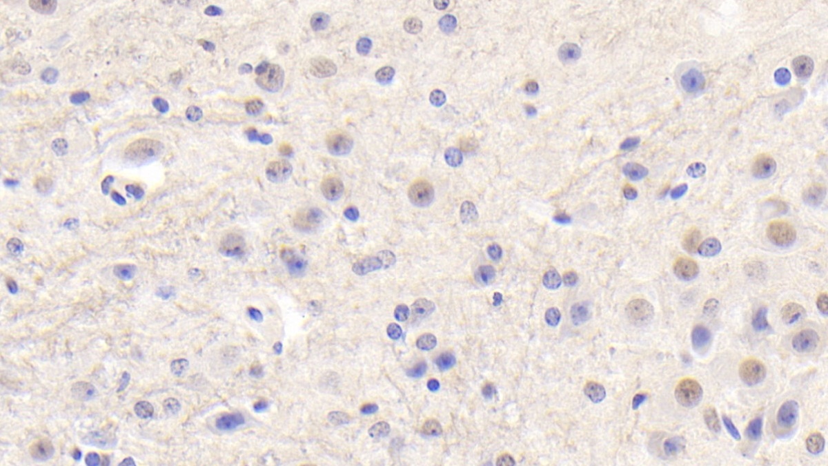 Polyclonal Antibody to Methylthioadenosine Phosphorylase (MTAP)