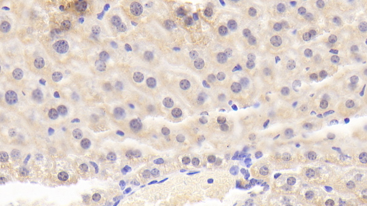 Polyclonal Antibody to Methylthioadenosine Phosphorylase (MTAP)