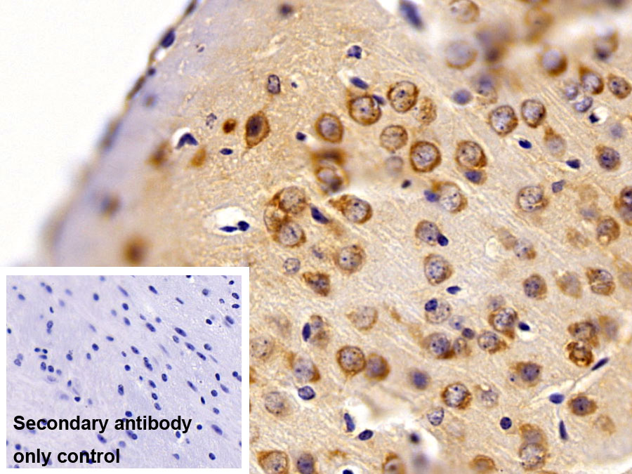 Polyclonal Antibody to Phenylalanyl tRNA Synthetase Alpha (FARSa)