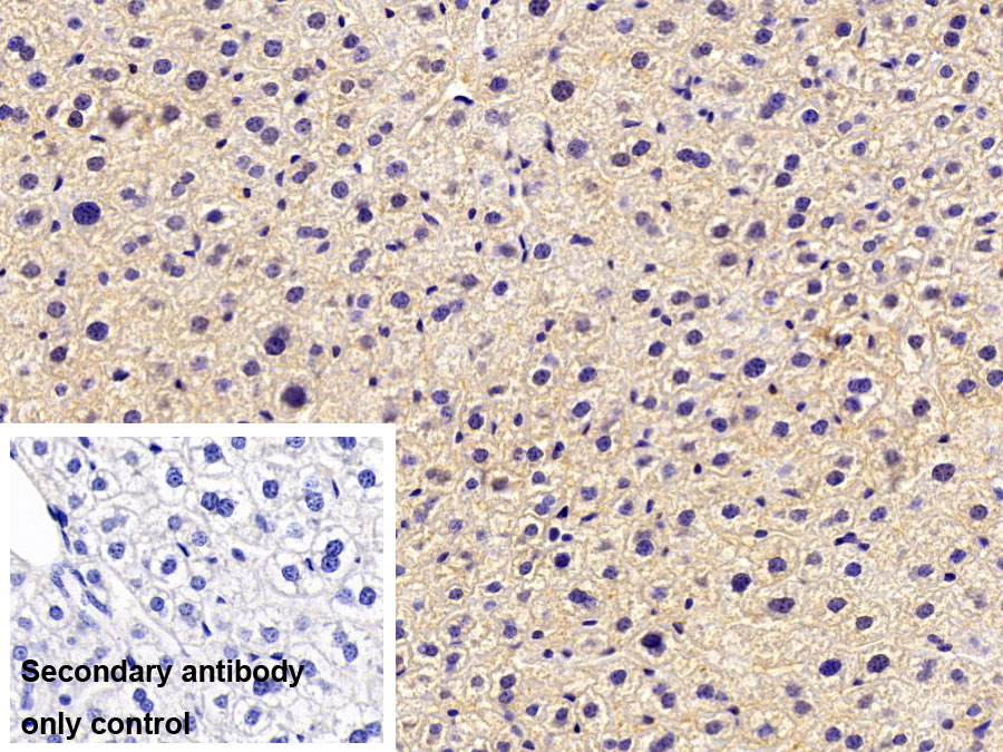 Polyclonal Antibody to Phenylalanyl tRNA Synthetase Alpha (FARSa)