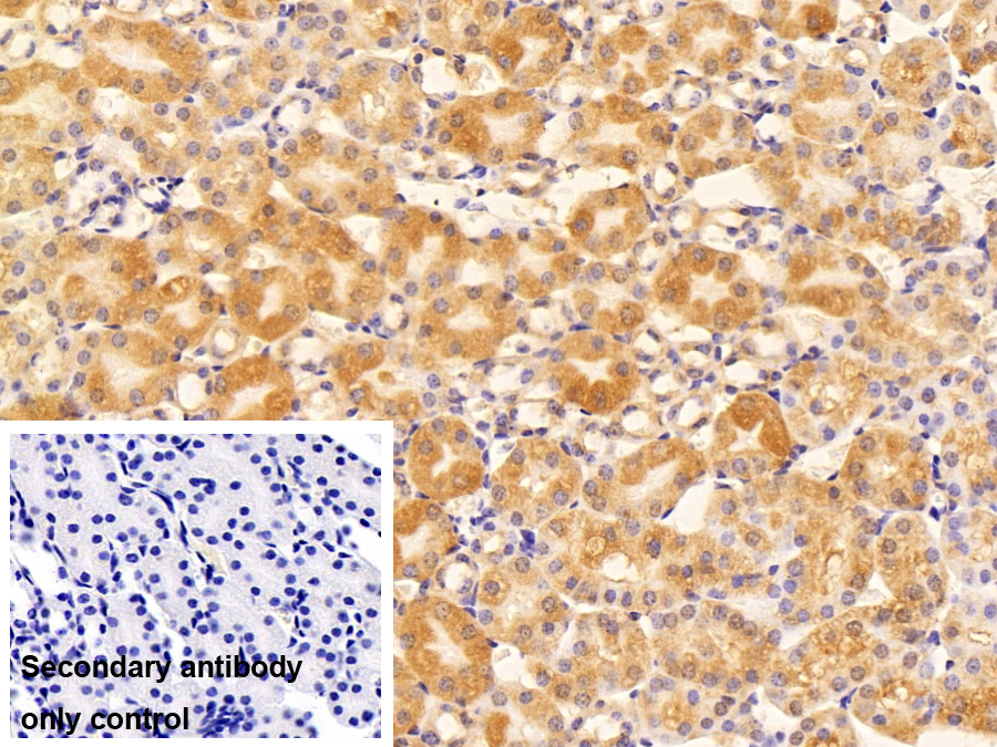 Polyclonal Antibody to Histidyl tRNA Synthetase 2, Mitochondrial (HARS2)