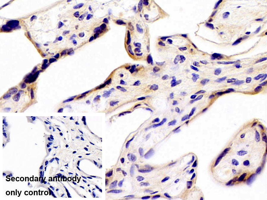 Polyclonal Antibody to Tyrosyl tRNA Synthetase 2, Mitochondrial (YARS2)