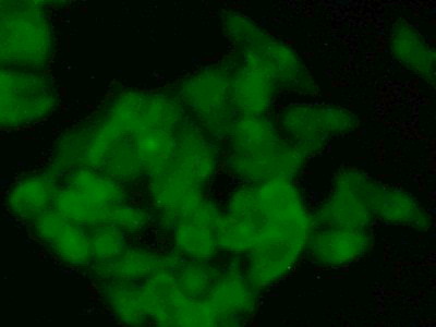 Polyclonal Antibody to N-Acetyltransferase 1 (NAT1)