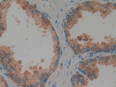 Polyclonal Antibody to Proteoglycan 4 (PRG4)