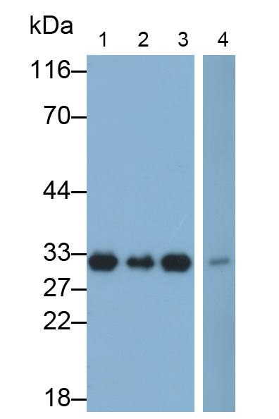 Polyclonal Antibody to Proteasome Subunit Beta Type 3 (PSMb3)