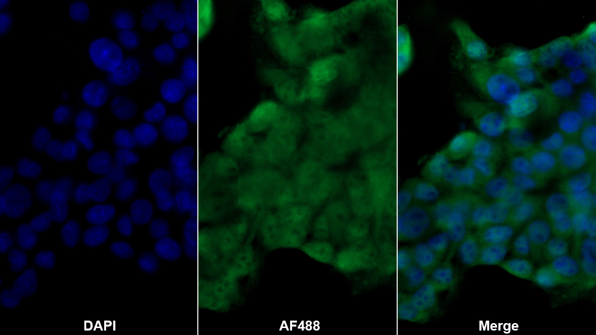 Polyclonal Antibody to Proteasome 26S Subunit, Non ATPase 4 (PSMD4)