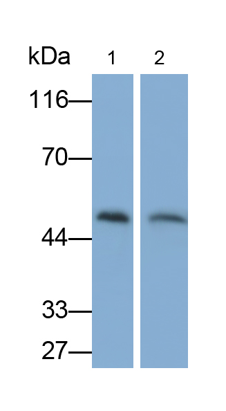 Polyclonal Antibody to Proteasome 26S Subunit, Non ATPase 5 (PSMD5)
