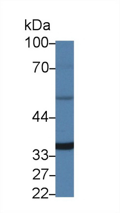 Polyclonal Antibody to Absent In Melanoma 2 (AIM2)