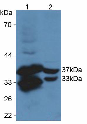 Polyclonal Antibody to Cysteine Rich Protein, Angiogenic Inducer 61 (CYR61)