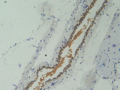 Polyclonal Antibody to Corin (CRN)