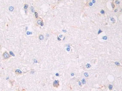 Polyclonal Antibody to Channel Activating Protease 1 (CAP1)