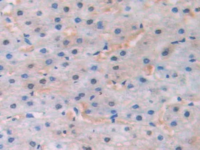 Polyclonal Antibody to Channel Activating Protease 1 (CAP1)