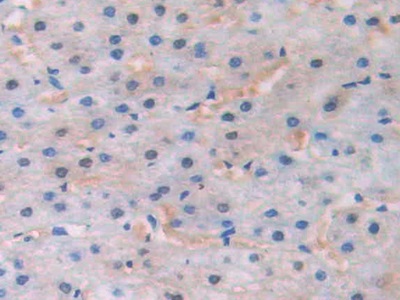 Polyclonal Antibody to Channel Activating Protease 1 (CAP1)