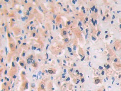 Polyclonal Antibody to Channel Activating Protease 1 (CAP1)