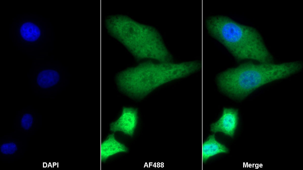 Polyclonal Antibody to Hypoxia Inducible Factor 1 Alpha Subunit Inhibitor (HIF1aN)