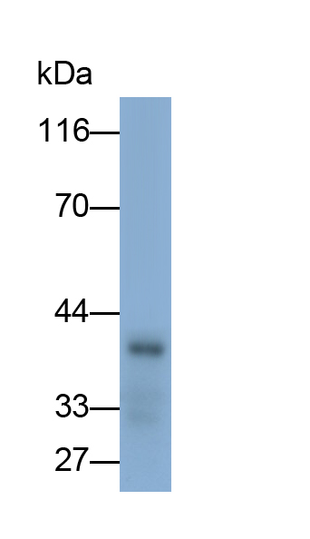 Polyclonal Antibody to 3-Hydroxybutyrate Dehydrogenase 1 (BDH1)