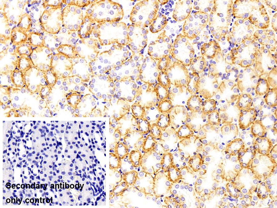 Polyclonal Antibody to ATPase, Na+/K+ Transporting Alpha 1 Polypeptide (ATP1a1)