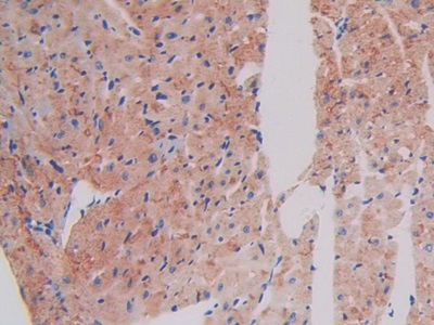 Polyclonal Antibody to ATPase, Na+/K+ Transporting Beta 1 Polypeptide (ATP1b1)