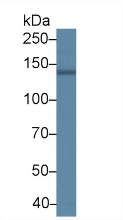 Polyclonal Antibody to ATPase, Ca++ Transporting, Cardiac Muscle, Slow Twitch 2 (ATP2A2)