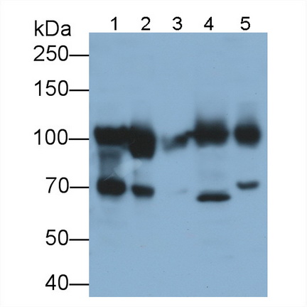 Polyclonal Antibody to ATPase, Ca++ Transporting, Cardiac Muscle, Slow Twitch 2 (ATP2A2)