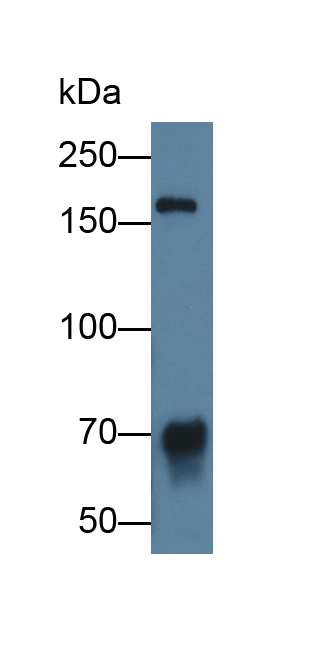 Polyclonal Antibody to ATPase, Cu++ Transporting Beta Polypeptide (ATP7b)