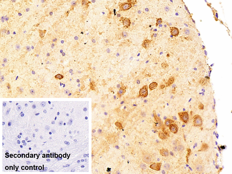 Polyclonal Antibody to ATPase, H+ Transporting, Mitochondrial F1 Complex Alpha Polypeptide (ATP5a)