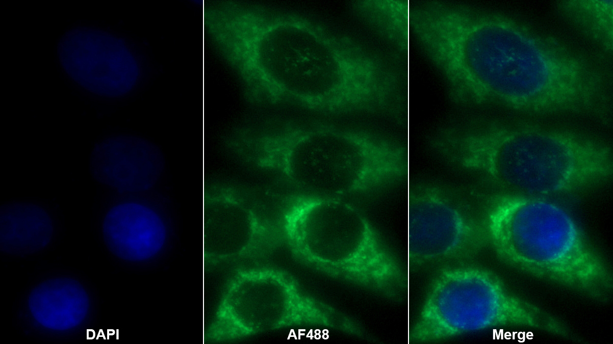 Polyclonal Antibody to ATPase Inhibitory Factor 1 (ATPIF1)