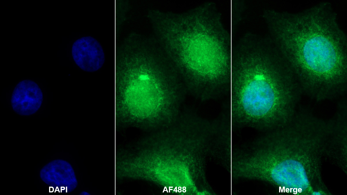 Polyclonal Antibody to Calbindin (CALB)
