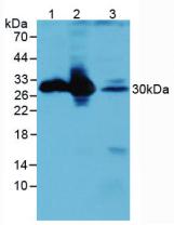 Polyclonal Antibody to Calbindin (CALB)