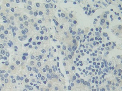 Polyclonal Antibody to Adenosylhomocysteinase (AHCY)