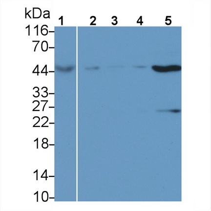 Polyclonal Antibody to Adenosylhomocysteinase (AHCY)