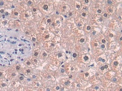 Polyclonal Antibody to Methionine Adenosyltransferase II Alpha (MAT2a)