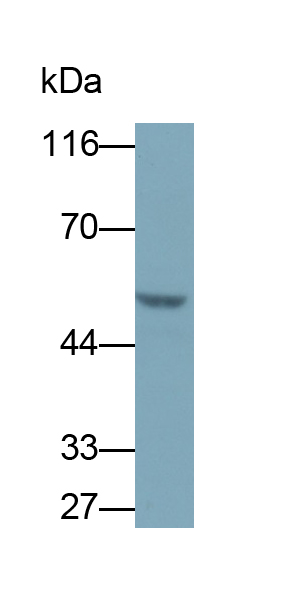 Polyclonal Antibody to Cysteine Sulfinic Acid Decarboxylase (CSAD)