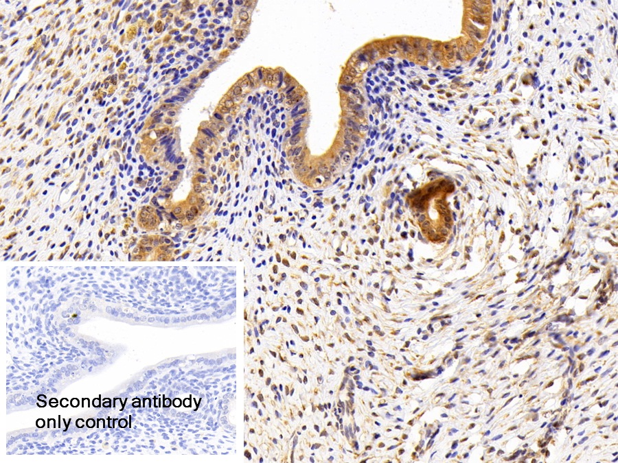Polyclonal Antibody to Lipin 1 (LPIN1)