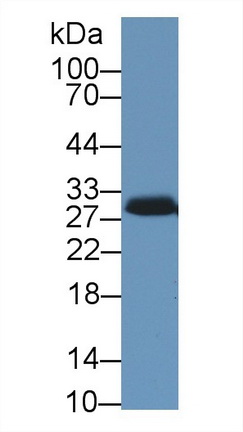 Polyclonal Antibody to Steroidogenic Acute Regulatory Protein (STAR)