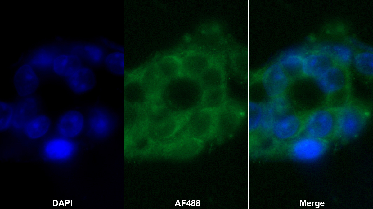 Polyclonal Antibody to Lysophosphatidylcholine Acyltransferase 3 (LPCAT3)