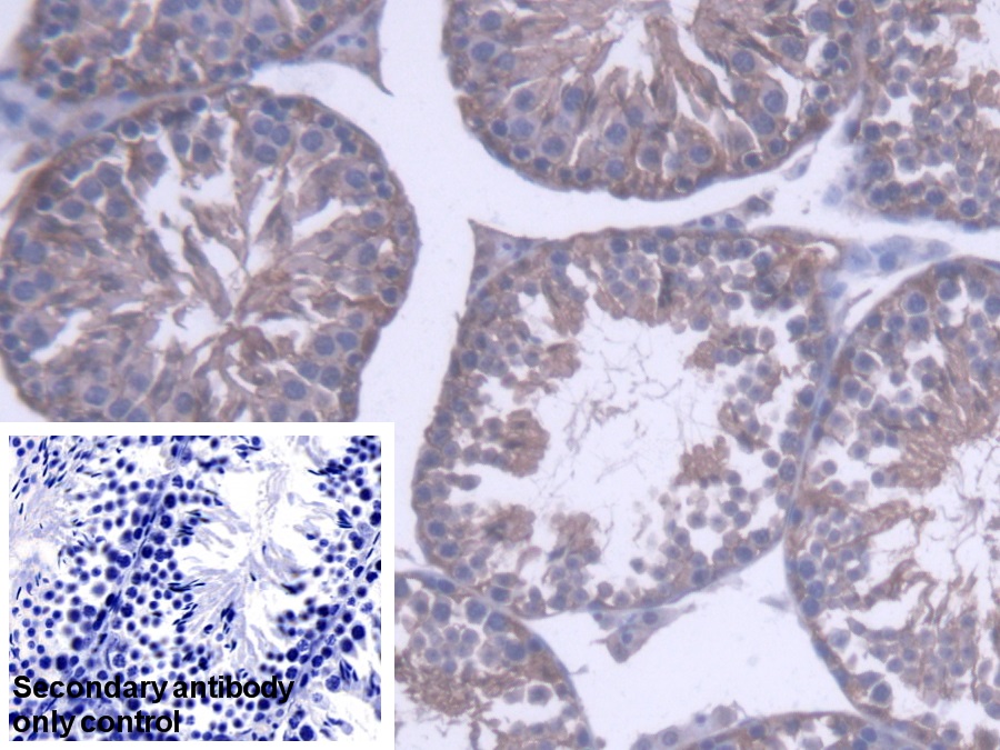 Polyclonal Antibody to Phosphatidylethanolamine Binding Protein 1 (PEBP1)