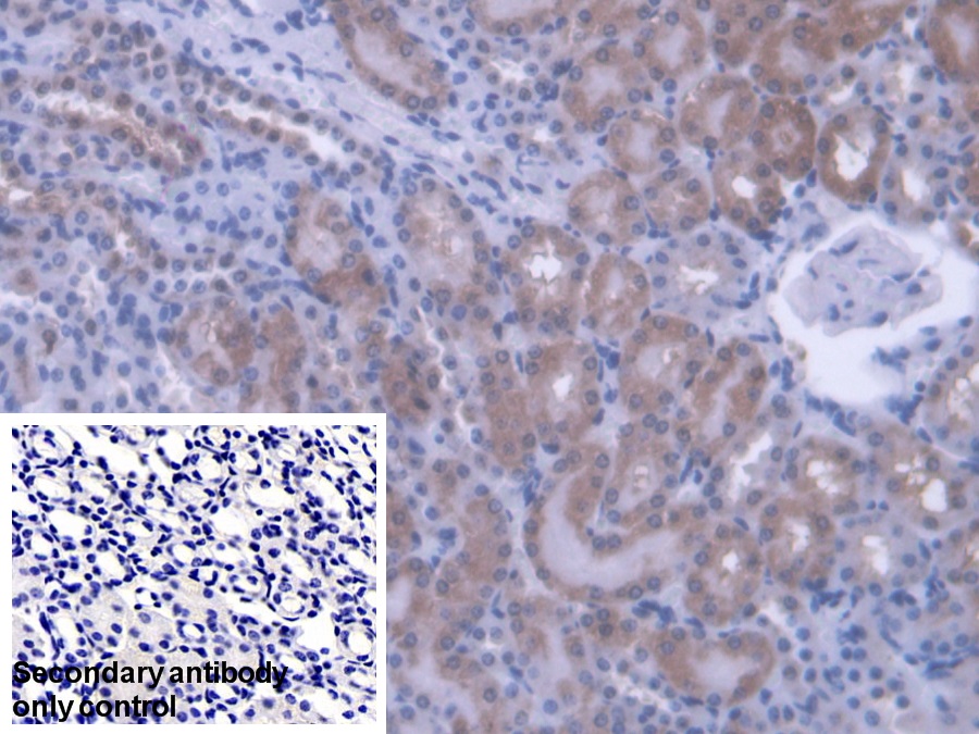 Polyclonal Antibody to Phosphatidylethanolamine Binding Protein 1 (PEBP1)