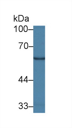 Polyclonal Antibody to Galactosylceramidase (GALC)