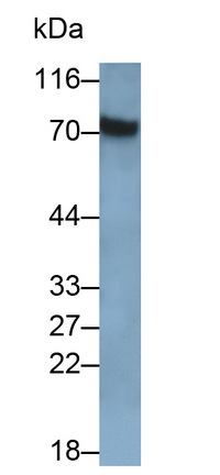 Polyclonal Antibody to Galactosylceramidase (GALC)