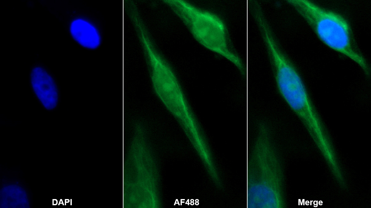 Polyclonal Antibody to Steroid Sulfatase Isozyme S (STS)