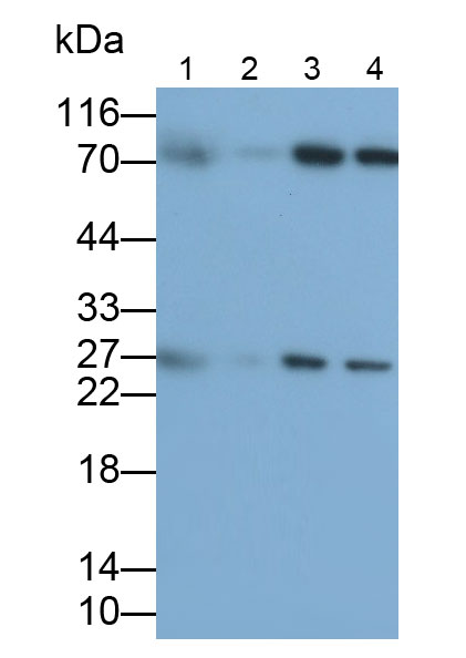 Polyclonal Antibody to Triggering Receptor Expressed On Myeloid Cells 2 (TREM2)