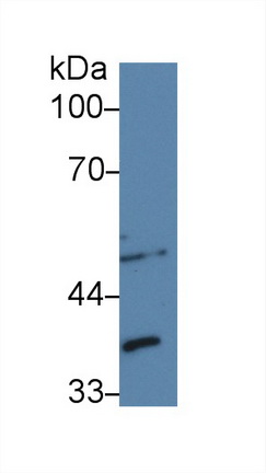 Polyclonal Antibody to Lens Epithelium Derived Growth Factor (LEDGF)